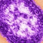 Connecticut reports first measles case of 2026