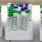Water samples taken in Cañon City show some is unsafe to drink