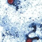 Blumenthal demands answers from FDA, Taylor Farms for Cyclospora outbreak