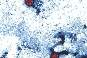 Blumenthal demands answers from FDA, Taylor Farms for Cyclospora outbreak